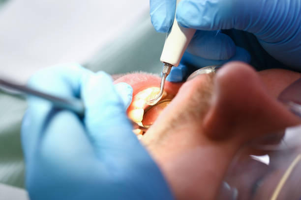Best Urgent Care for Lost Fillings or Crowns in Fairchance, PA